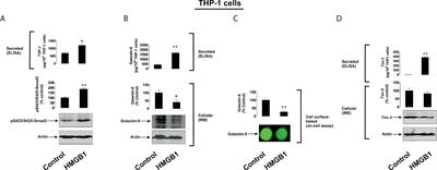 High Mobility Group Box 1 (HMGB1) Induces Toll-Like Receptor 4-Mediated Production of the Immunosuppressive Protein Galectin-9 in Human Cancer Cells